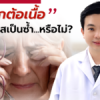 การผ่าตัดลอกต้อเนื้อ มีโอกาสเป็นซ้ำได้หรือไม่