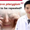 Is the procedure to remove pterygium likely to be repeated?