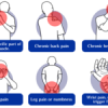 6 Symptoms Associated with Office Syndrome