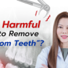 Is It Harmful Not to Remove “Wisdom Teeth” ?
