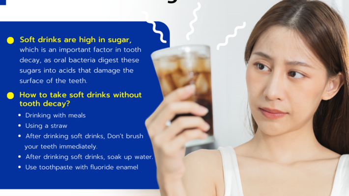 The soft drinks can be cause tooth decay?