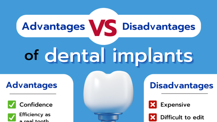 Advantages and Disadvantages of dental implants