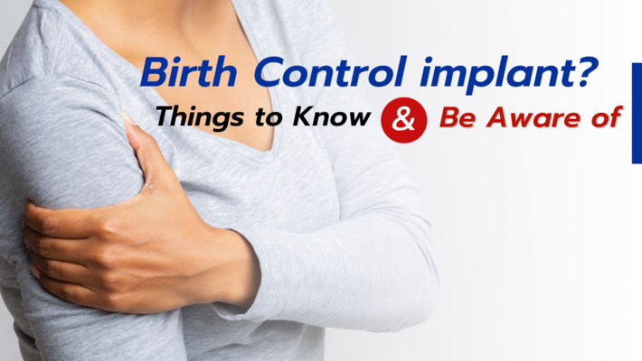 Birth Control implant? Things to Know & Be Aware of