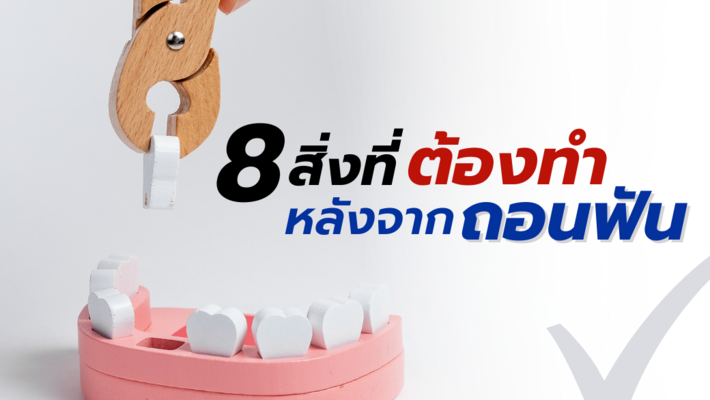 8 สิ่งที่ต้องทำหลังจาก ”ถอนฟัน”