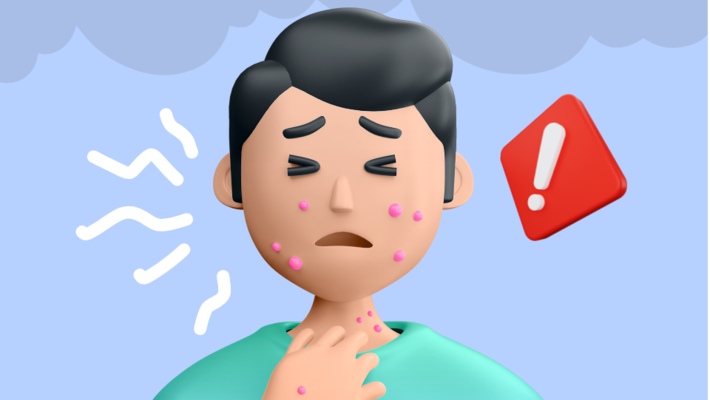 PM 2.5 กลับมาอีกแล้ว! เอาตัวรอดอย่างไรในช่วงค่าฝุ่นสูง