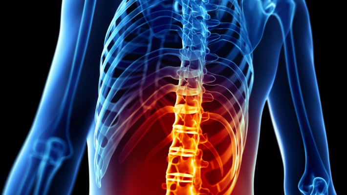 What kind of back pain indicates what disease?