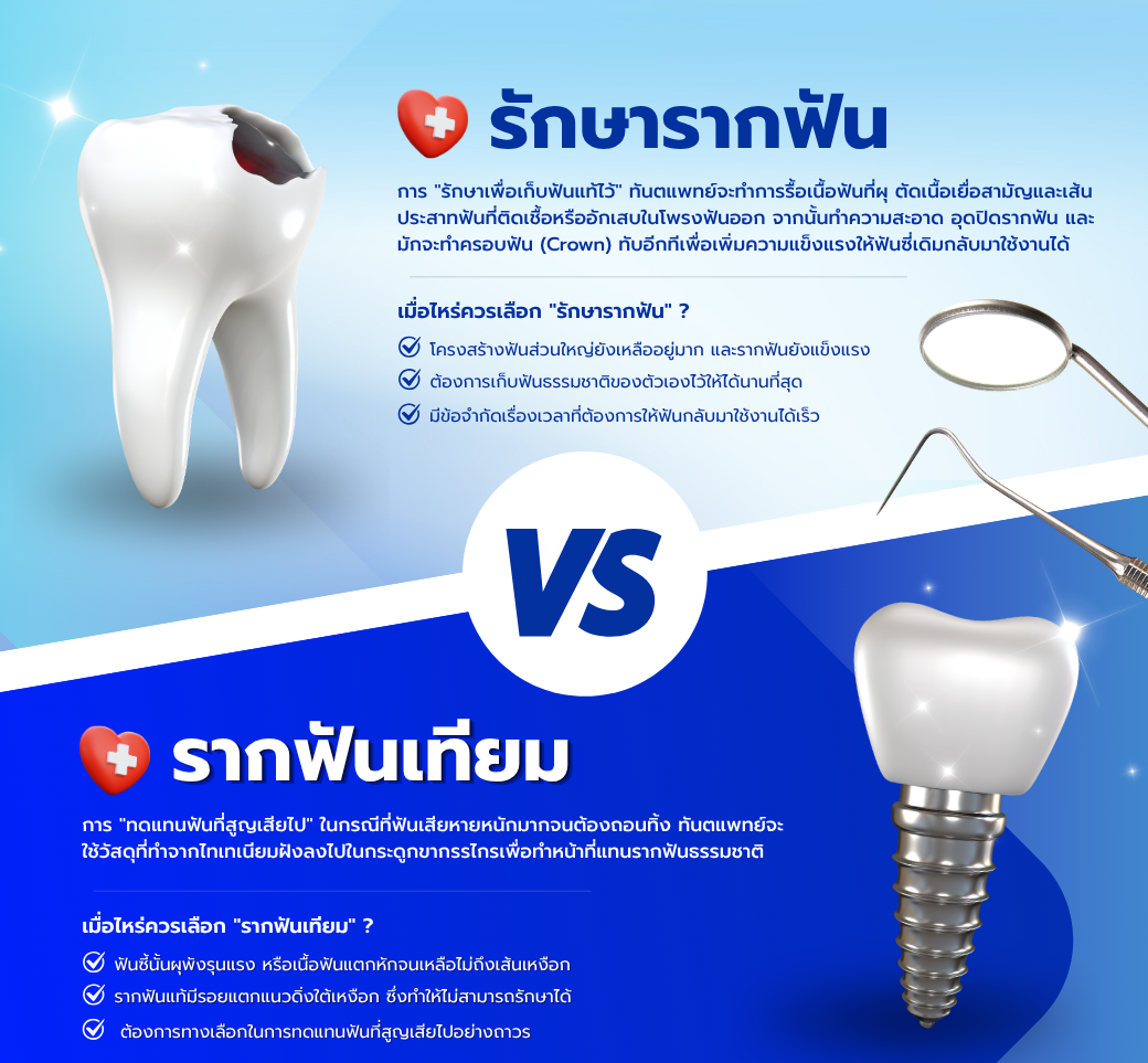 รักษารากฟันvsรากฟันเทียมความแตกต่างที่ควรรู้.png