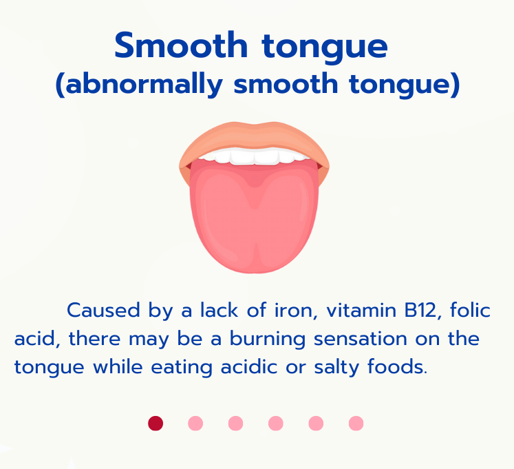 tongue vibration causes Clinical images showing the comparison of different tongue movements