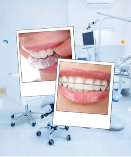 Retainers promotion