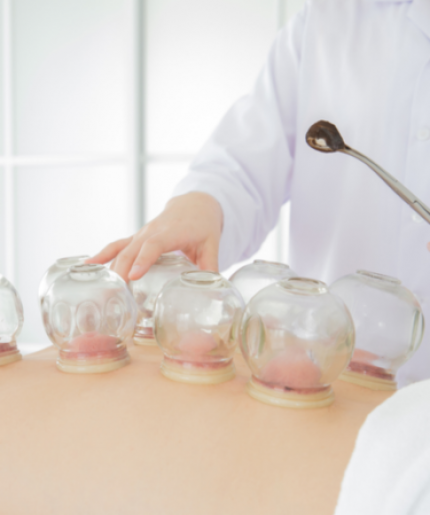 Cupping Therapy Program