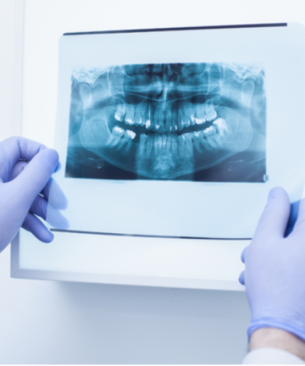 Dental X-ray Promotion