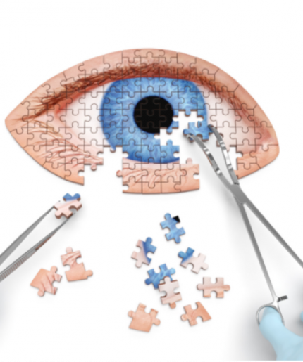 Cataract Surgery Package