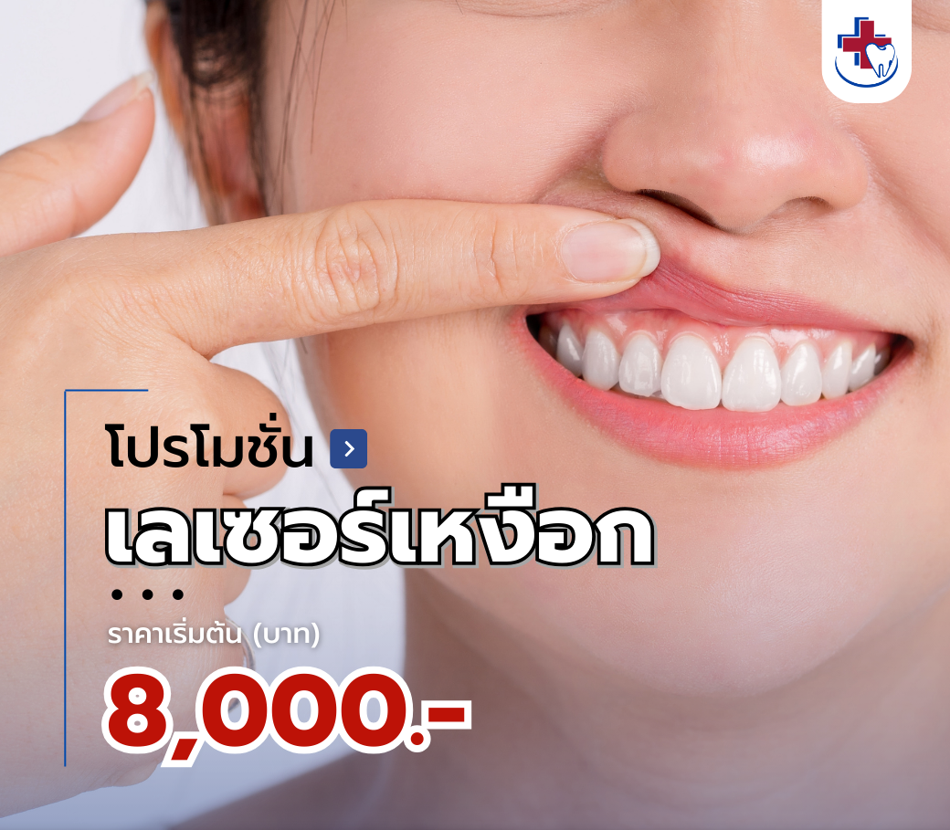 โปรโมชั่นเลเซอร์เหงือกแก้ปัญหาเหงือกดำ.png