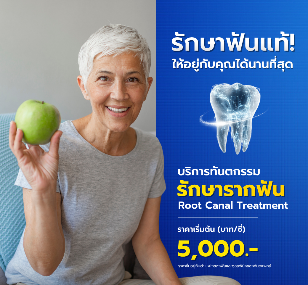 บริการรักษารากฟัน.png