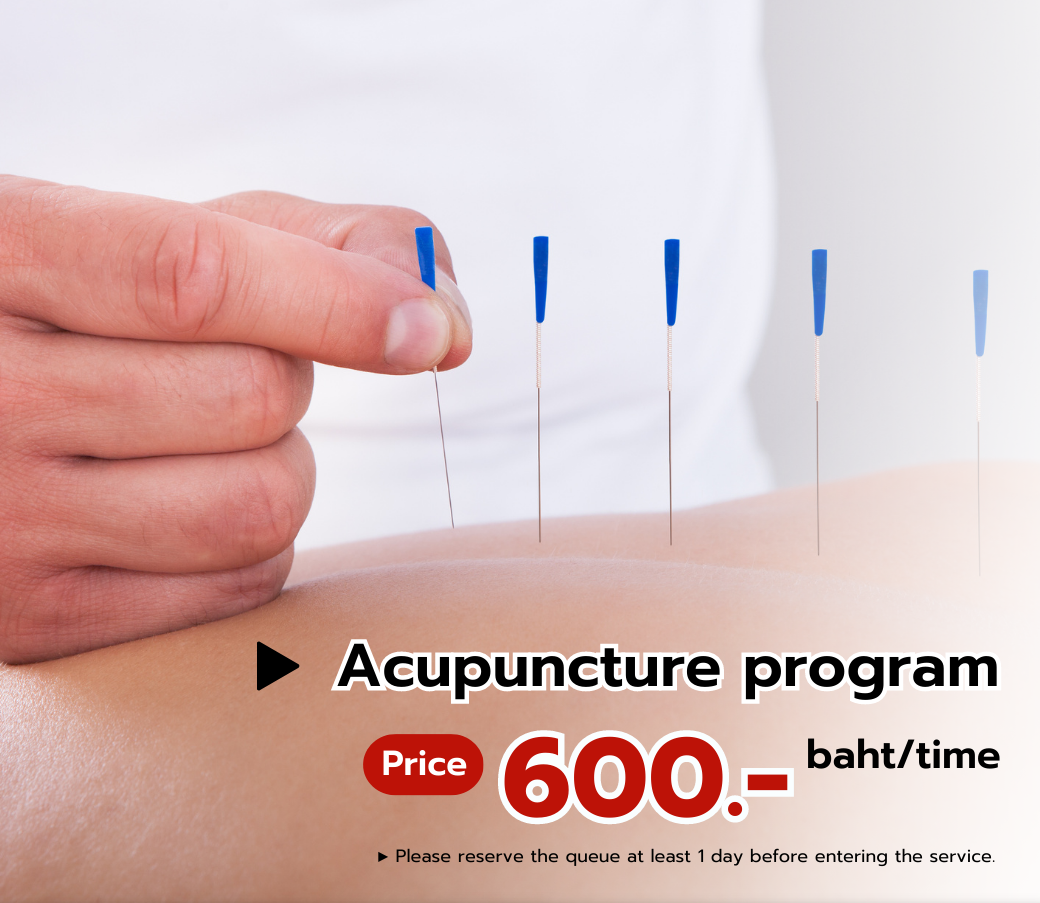 Acupuncture program to adjust the metabolic system Chiangmai Hospital