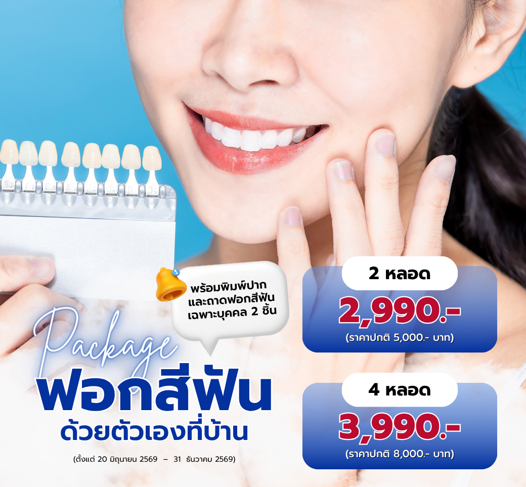แพ็กเกจฟอกสีฟันคืนรอยยิ้มสดใสเสริมมั่นใจให้คุณ.png