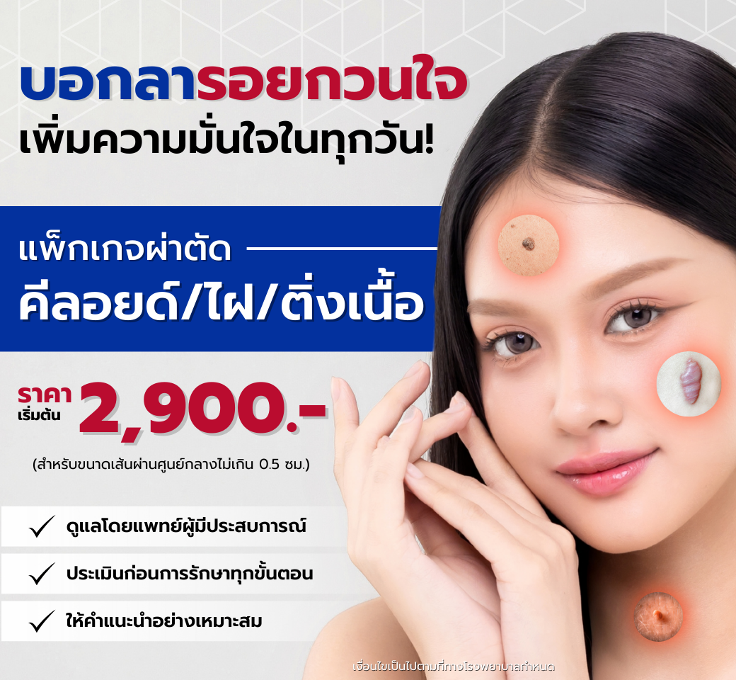 บริการผ่าตัดรักษาแผลคีลอยด์หรือไฝ.png