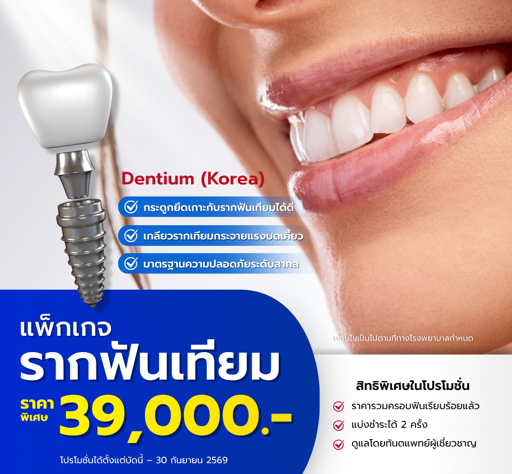 โปรโมชั่นรากฟันเทียม.png