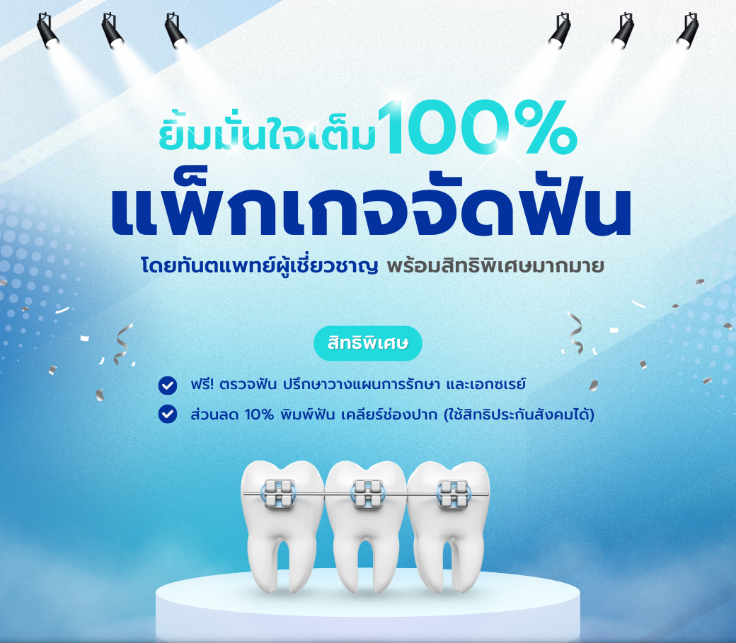 แพ็กเกจทันตกรรมจัดฟัน.png