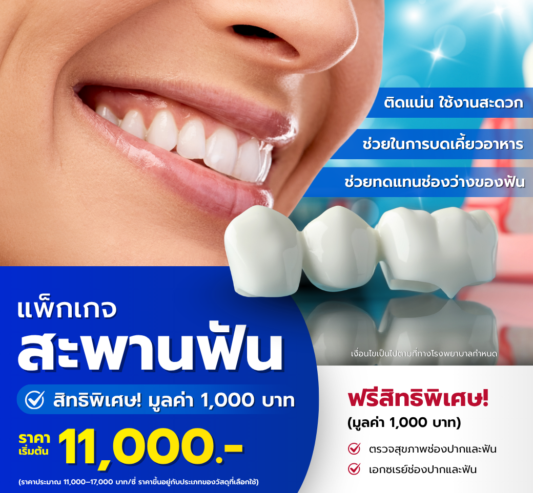 แพ็กเกจสะพานฟัน.png