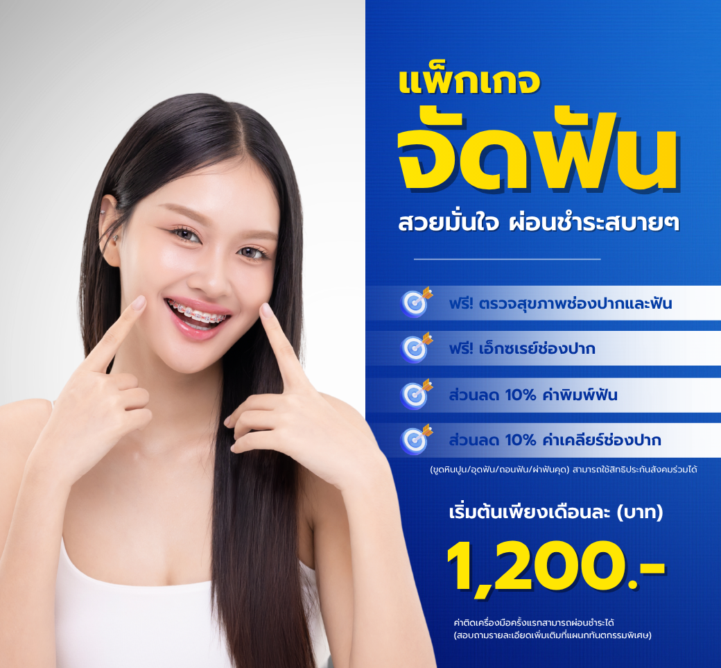 โปรโมชั่นจัดฟัน.png