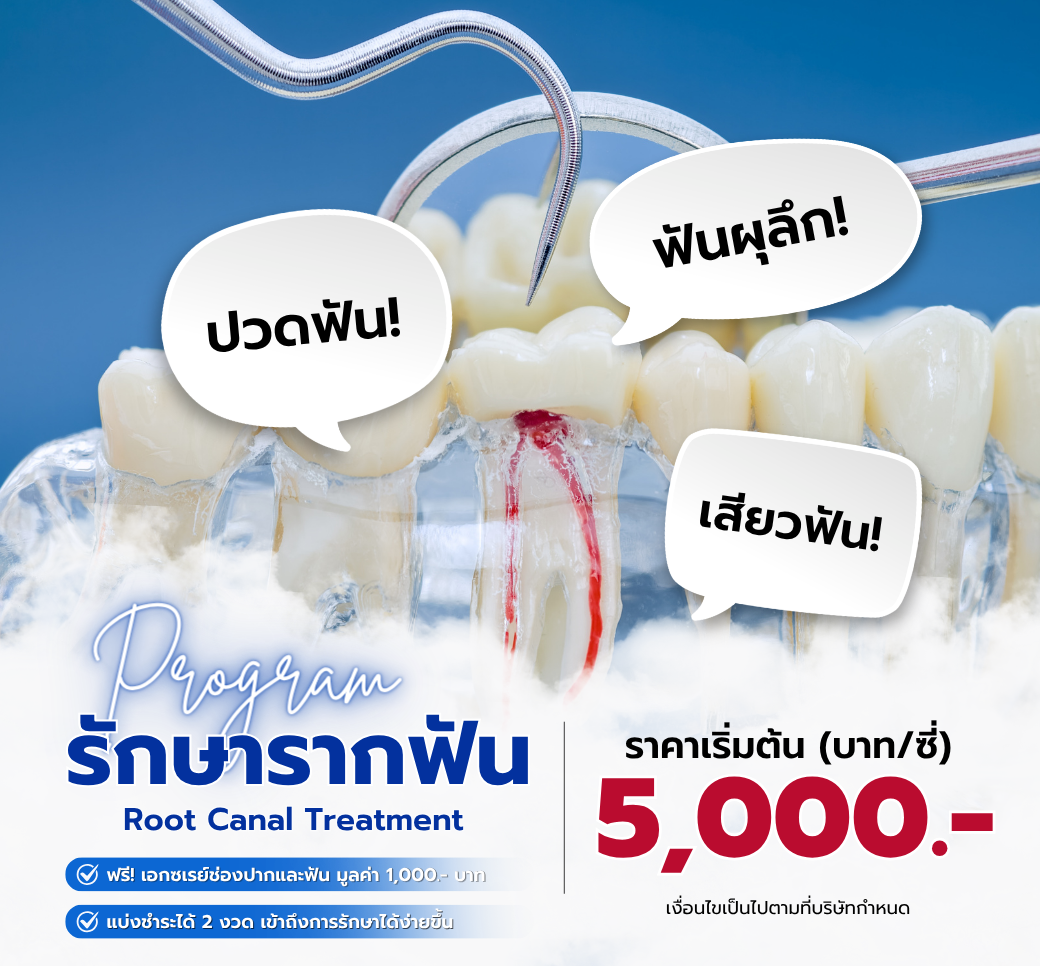 โปรโมชั่นรักษารากฟัน.png